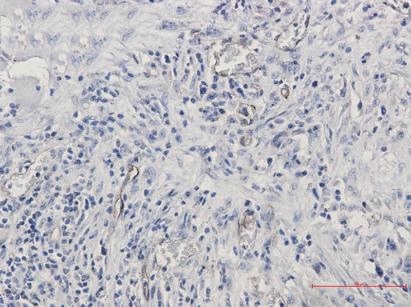 CD105 Rabbit mAb