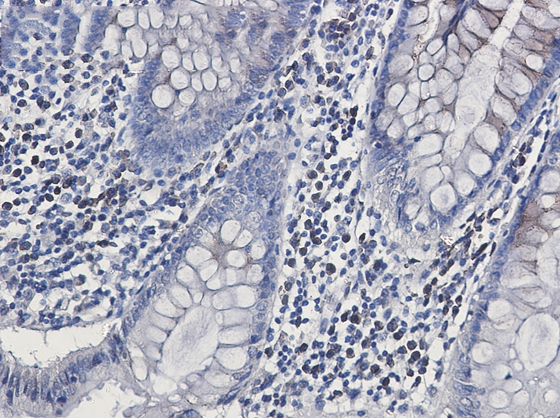 CLSTN1 Rabbit mAb