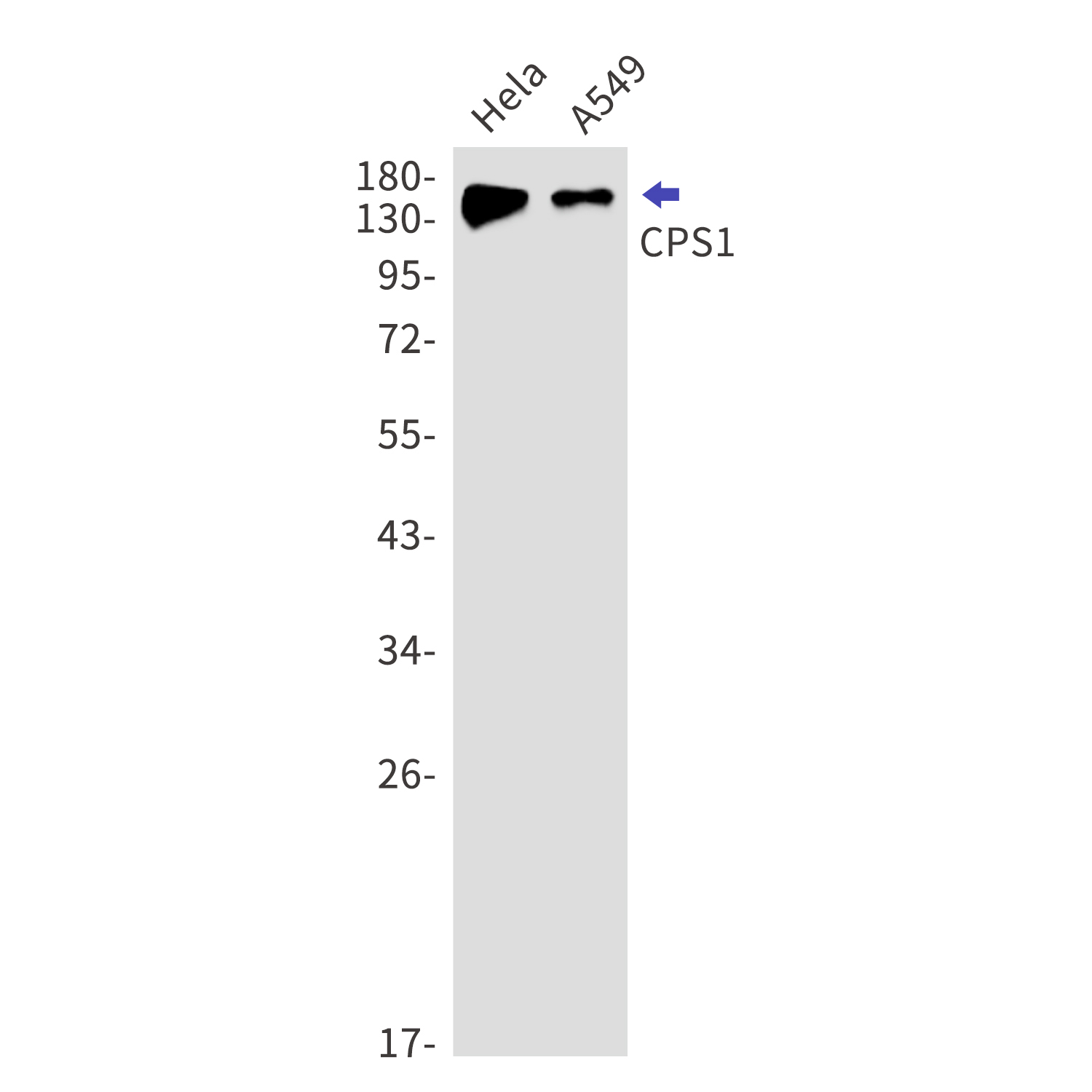 CPS1 Rabbit mAb