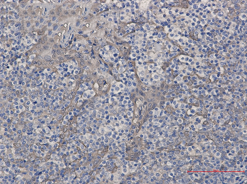 Cystatin B Rabbit mAb