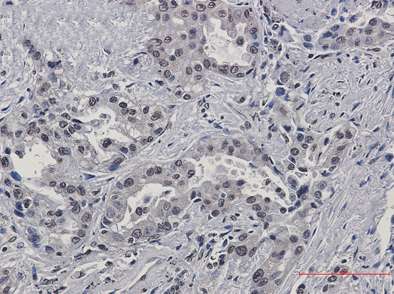 FKBP52 Rabbit mAb