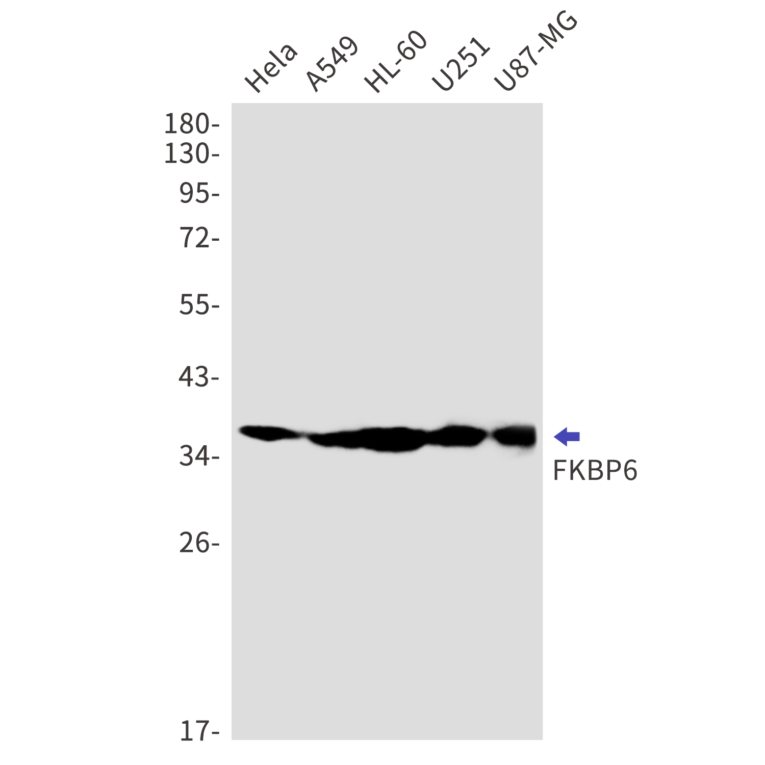 FKBP6 Rabbit mAb