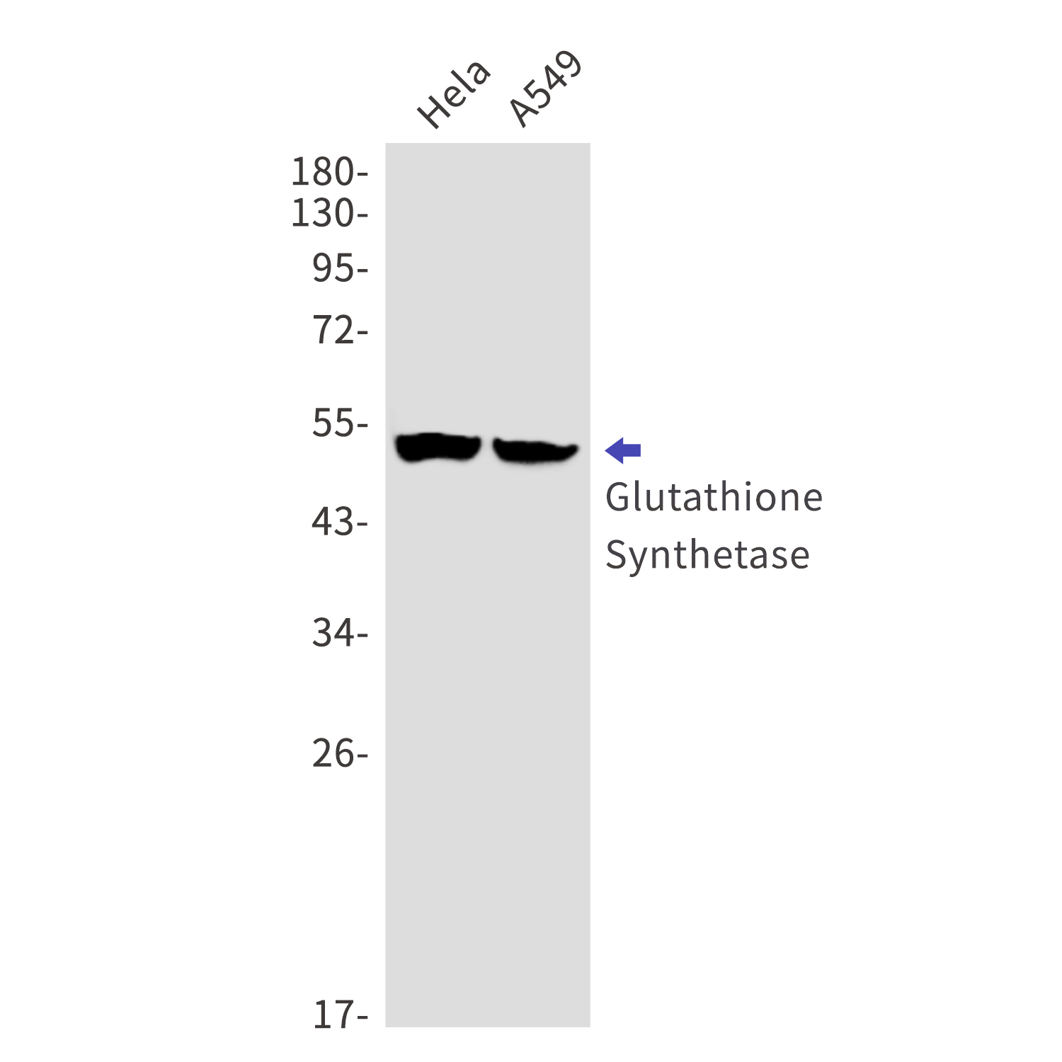 Glutathione Synthetase Rabbit mAb