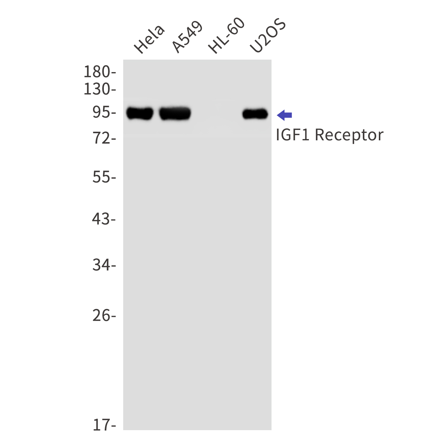 IGF1 Receptor Rabbit mAb