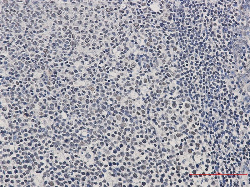 IKZF3 Rabbit mAb