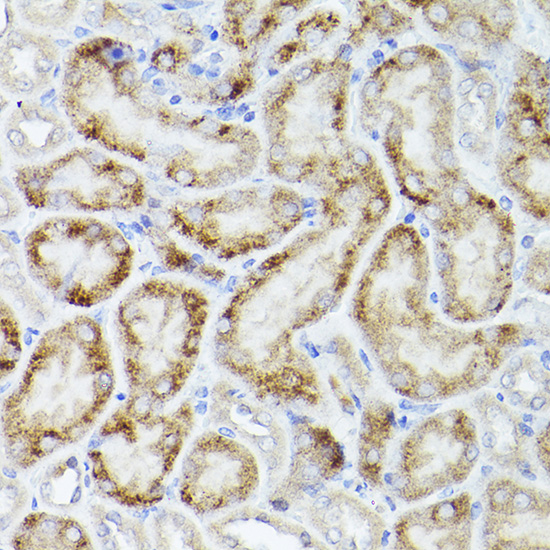 PGC1 alpha Polyclonal Antibody