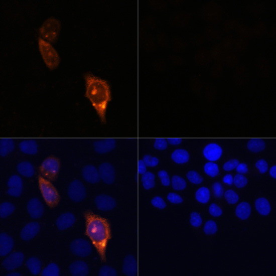 CAS9 Polyclonal Antibody