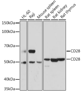 CD28 Rabbit Polyclonal Antibody