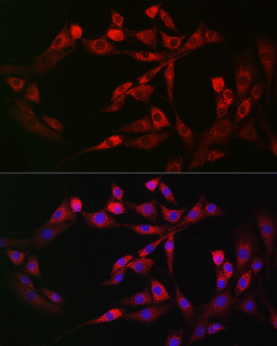 PIEZO1 Polyclonal Antibody