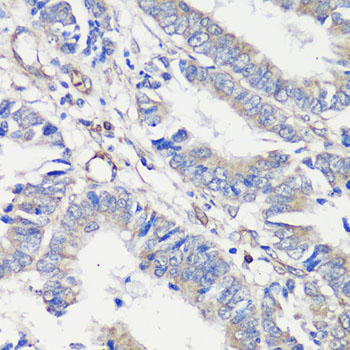 TNF antibody