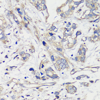 TNF antibody