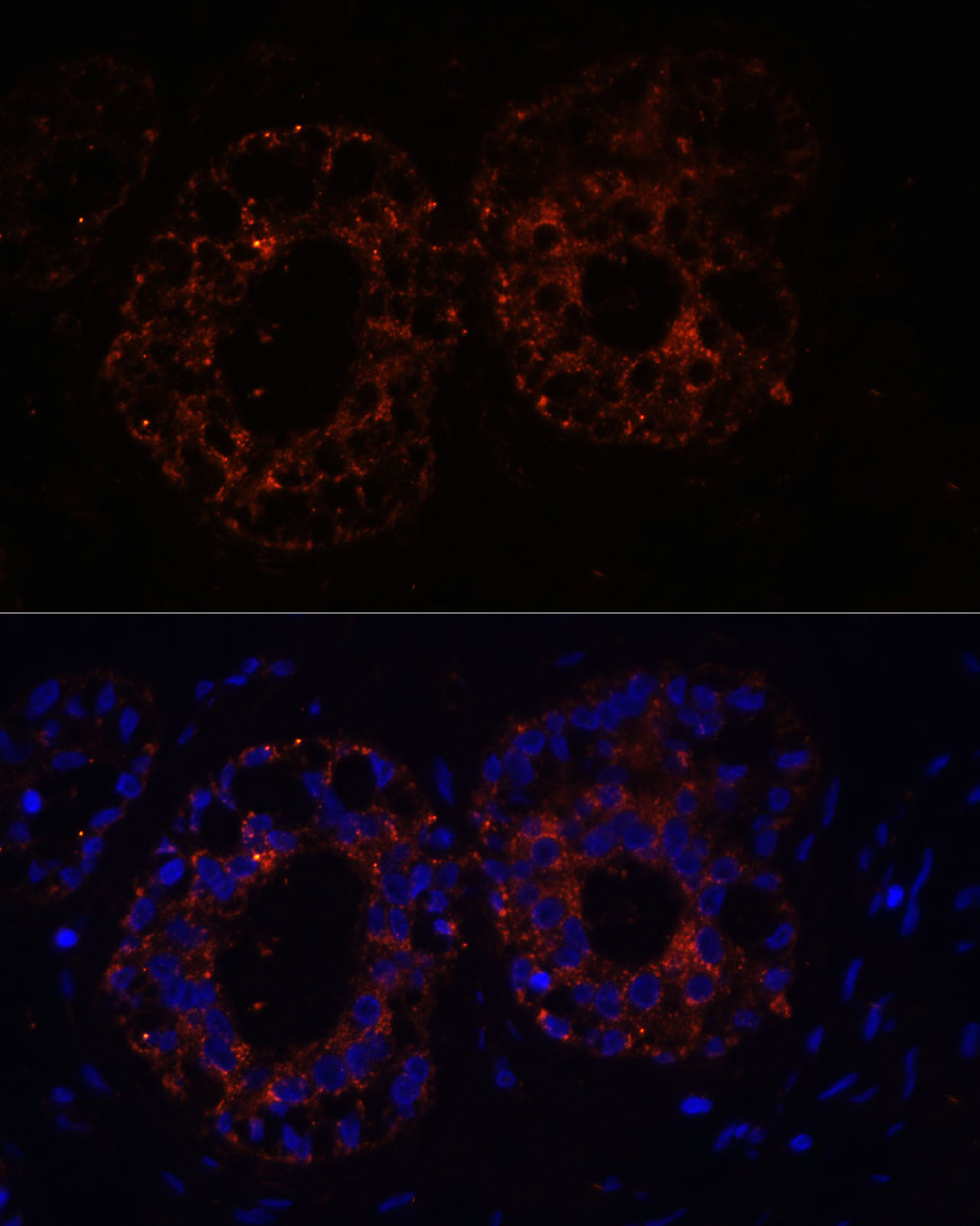 TNF antibody