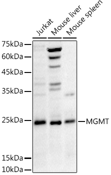 MGMT antibody