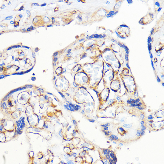 PECAM1 antibody