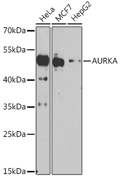 AURKA Rabbit Polyclonal Antibody