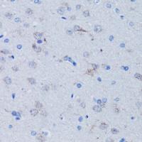 TFAM Rabbit Polyclonal Antibody