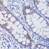 TFAM Rabbit Polyclonal Antibody