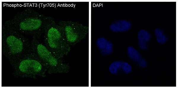 STAT3 (Phospho-Tyr705) Rabbit mAb