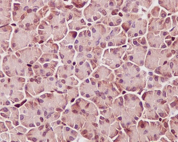 STAT3 (Phospho-Tyr705) Rabbit mAb