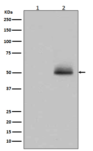 GSK3α/β(Phospho-Tyr216/Tyr279) Rabbit mAb