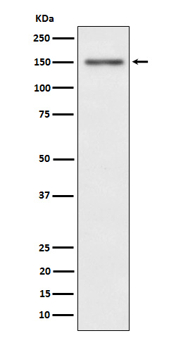 Met (c-Met) (Phospho-Tyr1349) Rabbit mAb