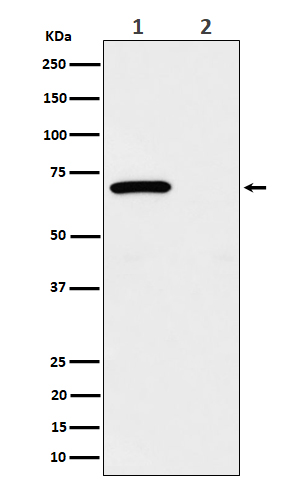 Chk2 (Phospho-Thr68) Rabbit mAb