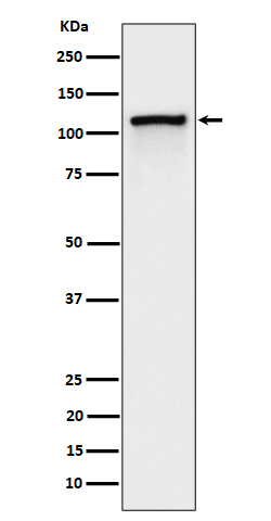 CBL (Phospho-Tyr774) Rabbit mAb