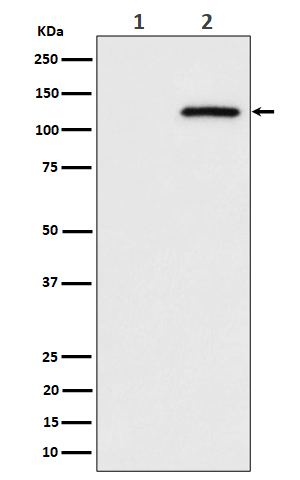 CBL(Phospho-Ser669) Rabbit mAb