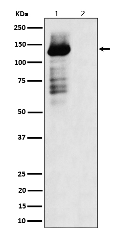 TAOK1/2/3 (Phospho-Ser181/Ser181/Ser177) Rabbit mAb