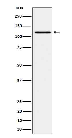 JAK1 (Phospho-Tyr1034/Tyr1035) Rabbit mAb