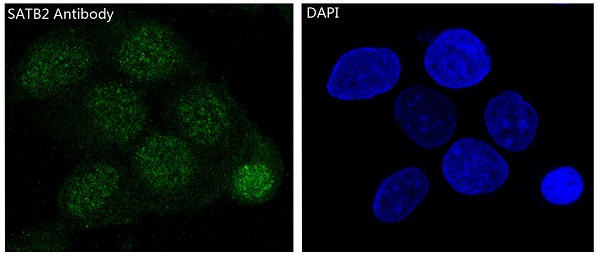 SATB2 Rabbit mAb