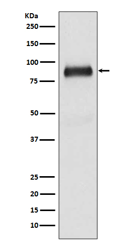 SATB2 Rabbit mAb