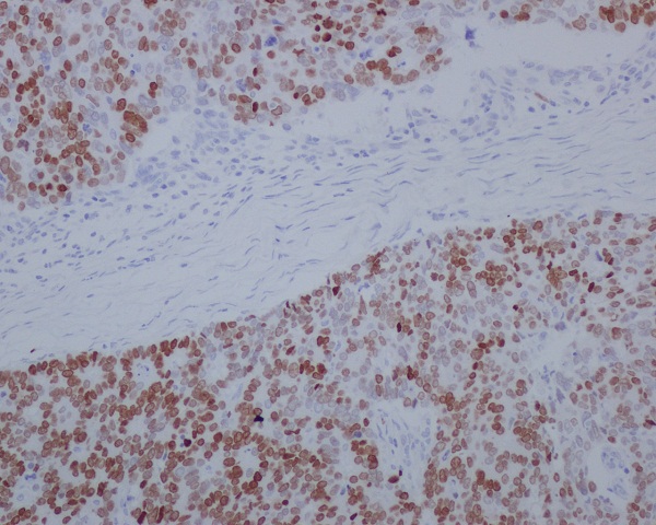 SATB2 Rabbit mAb