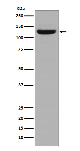 Collagen I Rabbit mAb