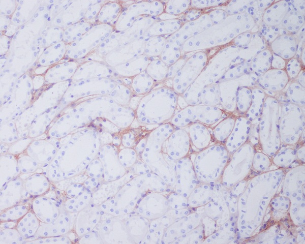 Collagen I Rabbit mAb