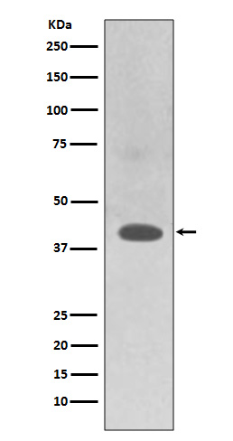 TRAM2 Rabbit mAb