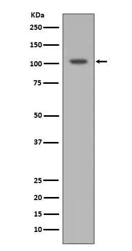 HIF-1 alpha Rabbit mAb