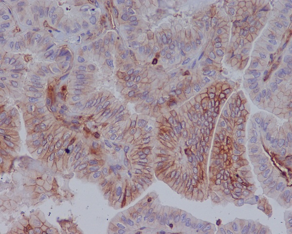 MHC class 1 Rabbit mAb