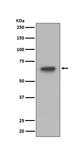 S6K1 Rabbit mAb