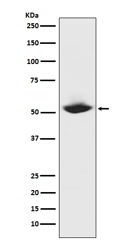 MMP1 Rabbit mAb