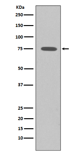 Somatostatin Receptor 2 Rabbit mAb