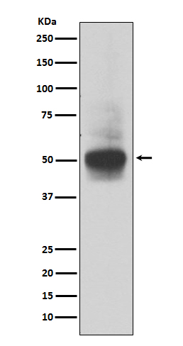 RUNX1/RUNX2/RUNX3 Rabbit mAb 