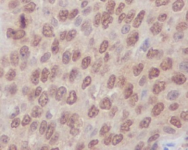 Rho A + B + C Rabbit mAb  