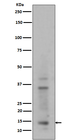 Histone H3 (mono+di+tri methyl K14) Rabbit mAb