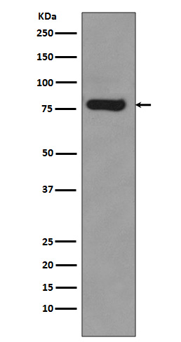 Androgen Receptor(AR-V7 specific) Rabbit mAb