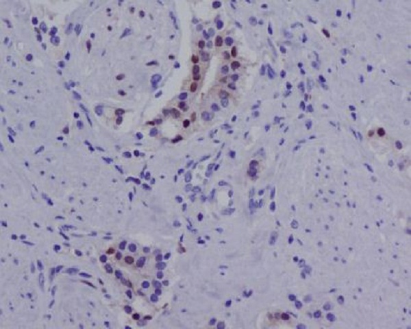 Androgen Receptor(AR-V7 specific) Rabbit mAb