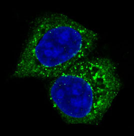 Akt(pan) 1/2/3 Rabbit mAb 