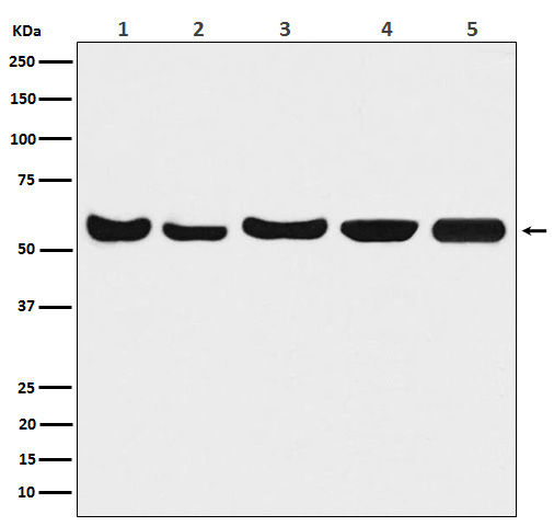 Akt(pan) 1/2/3 Rabbit mAb 