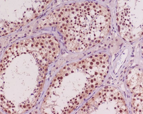 Akt(pan) 1/2/3 Rabbit mAb 