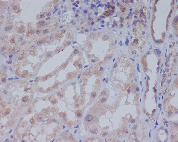 Acetyl-CoA Carboxylase Rabbit mAb